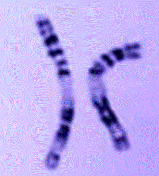 chromosome 11
